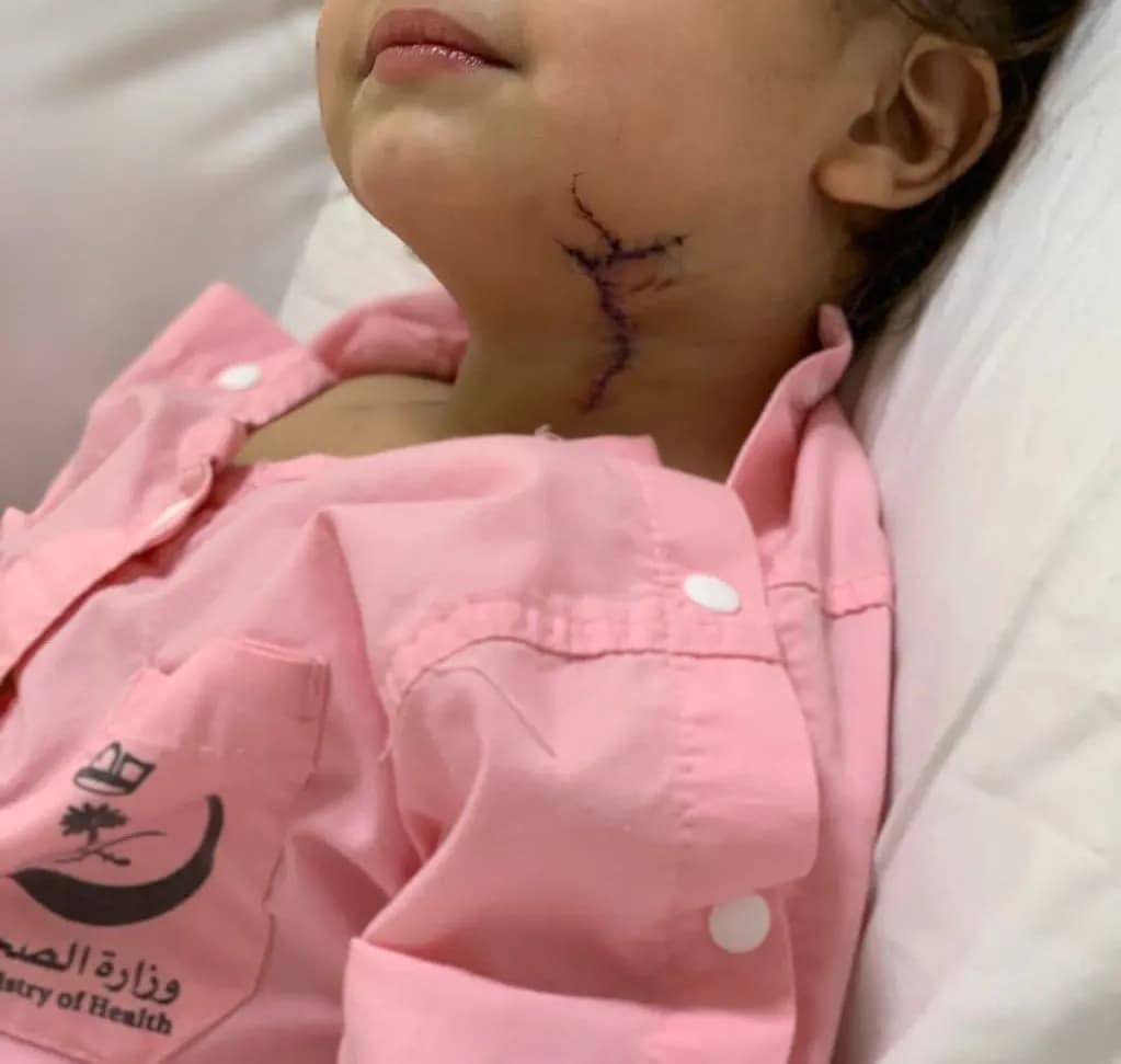 طاولة زجاجية تنقل طفلة سعودية إلى غرفة العمليات2_ssict_1023_971