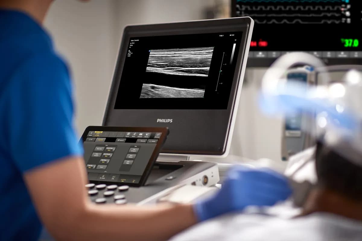Compact Ultrasound System 5000 Series_Philips_ssict_1200_800